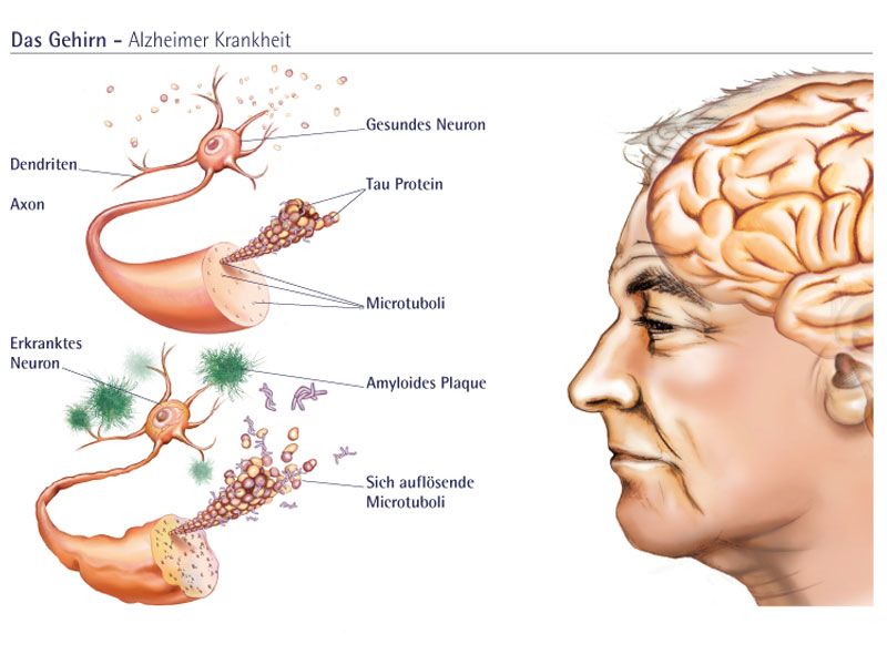 Gehirns und Neuronendetails